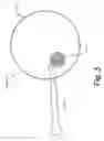 Fig. 04 - Tissue Marking For Lesion Removal