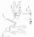 Fig. 08 - Tissue Marking For Lesion Removal