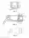 Fig. 04 - Capsule for mixing and dispensing a dental material