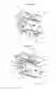 Fig. 02 - LOW PROFILE SELF-LIGATING ORTHODONTIC BRACKET