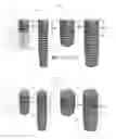 Fig. 02 - Dental implant having tapered threaded surface with installation enhancement features
