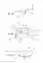 Fig. 07 - Method of treating urinary incontinence