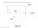 Fig. 37 - Method of treating urinary incontinence