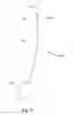 Fig. 40 - Method of treating urinary incontinence