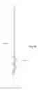 Fig. 49 - Method of treating urinary incontinence