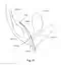 Fig. 55 - Method of treating urinary incontinence