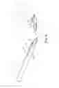 Fig. 07 - Tissue anchor and a suture inserted through the tissue anchor having end portions of the suture maintained within a conduit