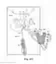 Fig. 24 - Tissue anchor and a suture inserted through the tissue anchor having end portions of the suture maintained within a conduit