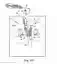 Fig. 30 - Tissue anchor and a suture inserted through the tissue anchor having end portions of the suture maintained within a conduit