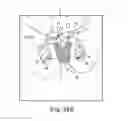 Fig. 32 - Tissue anchor and a suture inserted through the tissue anchor having end portions of the suture maintained within a conduit