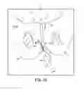 Fig. 53 - Tissue anchor and a suture inserted through the tissue anchor having end portions of the suture maintained within a conduit