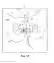 Fig. 56 - Tissue anchor and a suture inserted through the tissue anchor having end portions of the suture maintained within a conduit