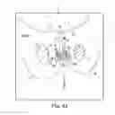 Fig. 60 - Tissue anchor and a suture inserted through the tissue anchor having end portions of the suture maintained within a conduit