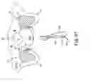 Fig. 65 - Tissue anchor and a suture inserted through the tissue anchor having end portions of the suture maintained within a conduit