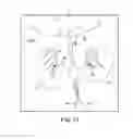 Fig. 70 - Tissue anchor and a suture inserted through the tissue anchor having end portions of the suture maintained within a conduit
