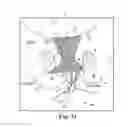 Fig. 72 - Tissue anchor and a suture inserted through the tissue anchor having end portions of the suture maintained within a conduit
