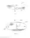 Fig. 02 - Reinforcement device with dissolvable layer and its use