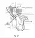 Fig. 07 - Method and prosthesis for percutaneous hernia repair