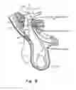 Fig. 09 - Method and prosthesis for percutaneous hernia repair