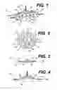 Fig. 02 - Intraocular lens (IOL)