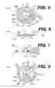 Fig. 03 - Intraocular lens (IOL)