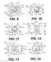 Fig. 04 - Intraocular lens (IOL)