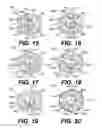 Fig. 05 - Intraocular lens (IOL)