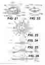 Fig. 06 - Intraocular lens (IOL)