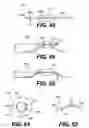 Fig. 12 - Intraocular lens (IOL)