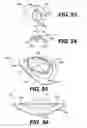 Fig. 13 - Intraocular lens (IOL)