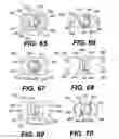 Fig. 16 - Intraocular lens (IOL)