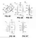 Fig. 19 - Intraocular lens (IOL)