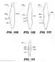 Fig. 23 - Intraocular lens (IOL)