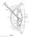 Fig. 03 - Intraocular lens having a capsular ring for inhibiting capsular opacification