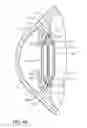 Fig. 04 - Intraocular lens having a capsular ring for inhibiting capsular opacification