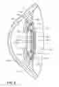 Fig. 07 - Intraocular lens having a capsular ring for inhibiting capsular opacification
