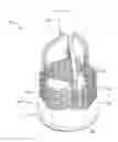 Fig. 01 - Replacement heart valve implant