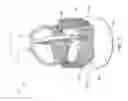 Fig. 02 - Replacement heart valve implant