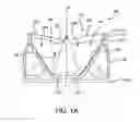 Fig. 02 - Asymmetric opening and closing prosthetic valve leaflet