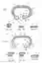 Fig. 05 - Annuloplasty ring with reduced dehiscence