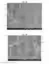 Fig. 09 - Surface treatment for an implant surface