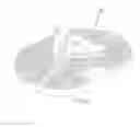 Fig. 10 - ORTHOPAEDIC IMPLANTS AND METHODS