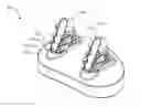 Fig. 01 - Glenoid arthroplasty with multi-directional fixation