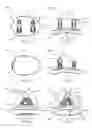 Fig. 05 - Glenoid arthroplasty with multi-directional fixation