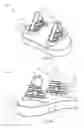 Fig. 06 - Glenoid arthroplasty with multi-directional fixation