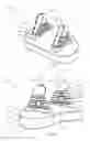Fig. 10 - Glenoid arthroplasty with multi-directional fixation