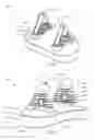 Fig. 14 - Glenoid arthroplasty with multi-directional fixation