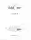 Fig. 04 - Ball and socket implants for correction of hammer toes and claw toes