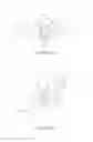 Fig. 06 - Ball and socket implants for correction of hammer toes and claw toes
