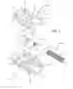 Fig. 04 - Expandable spinal implant and method of implanting same